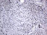 PPP1R8 Antibody in Immunohistochemistry (Paraffin) (IHC (P))