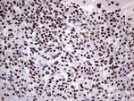 PPP1R8 Antibody in Immunohistochemistry (Paraffin) (IHC (P))