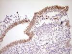 NOR-1 Antibody in Immunohistochemistry (Paraffin) (IHC (P))