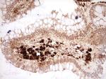 NOR-1 Antibody in Immunohistochemistry (Paraffin) (IHC (P))