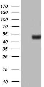 ASL Antibody in Western Blot (WB)