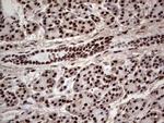 SAE1 Antibody in Immunohistochemistry (Paraffin) (IHC (P))