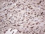 SAE1 Antibody in Immunohistochemistry (Paraffin) (IHC (P))