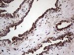 SAE1 Antibody in Immunohistochemistry (Paraffin) (IHC (P))