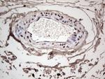 SAE1 Antibody in Immunohistochemistry (Paraffin) (IHC (P))