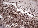 SAE1 Antibody in Immunohistochemistry (Paraffin) (IHC (P))