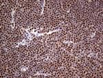 SAE1 Antibody in Immunohistochemistry (Paraffin) (IHC (P))