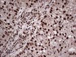 SAE1 Antibody in Immunohistochemistry (Paraffin) (IHC (P))