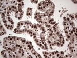 SAE1 Antibody in Immunohistochemistry (Paraffin) (IHC (P))