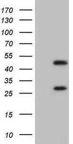 MB67 Antibody in Western Blot (WB)