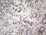 SAE1 Antibody in Immunohistochemistry (Paraffin) (IHC (P))