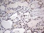 SAE1 Antibody in Immunohistochemistry (Paraffin) (IHC (P))