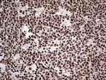 SAE1 Antibody in Immunohistochemistry (Paraffin) (IHC (P))