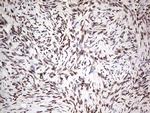 SAE1 Antibody in Immunohistochemistry (Paraffin) (IHC (P))