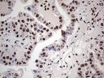 SAE1 Antibody in Immunohistochemistry (Paraffin) (IHC (P))