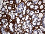 TGFBI Antibody in Immunohistochemistry (Paraffin) (IHC (P))