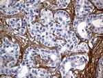 TGFBI Antibody in Immunohistochemistry (Paraffin) (IHC (P))