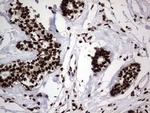 hnRNP L Antibody in Immunohistochemistry (Paraffin) (IHC (P))