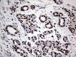 hnRNP L Antibody in Immunohistochemistry (Paraffin) (IHC (P))