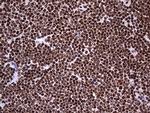 hnRNP L Antibody in Immunohistochemistry (Paraffin) (IHC (P))