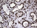 hnRNP L Antibody in Immunohistochemistry (Paraffin) (IHC (P))