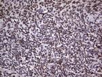 TLK2 Antibody in Immunohistochemistry (Paraffin) (IHC (P))