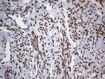 TLK2 Antibody in Immunohistochemistry (Paraffin) (IHC (P))