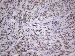 TLK2 Antibody in Immunohistochemistry (Paraffin) (IHC (P))