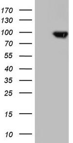 TLK2 Antibody in Western Blot (WB)