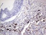 TLK2 Antibody in Immunohistochemistry (Paraffin) (IHC (P))