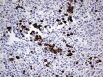 TLK2 Antibody in Immunohistochemistry (Paraffin) (IHC (P))