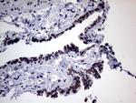 TLK2 Antibody in Immunohistochemistry (Paraffin) (IHC (P))