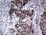 TLK2 Antibody in Immunohistochemistry (Paraffin) (IHC (P))