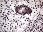 TLK2 Antibody in Immunohistochemistry (Paraffin) (IHC (P))