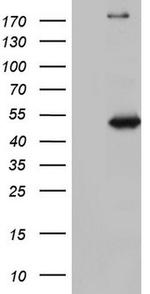 NUDT12 Antibody in Western Blot (WB)