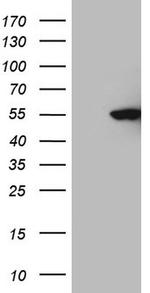 CDKL2 Antibody in Western Blot (WB)