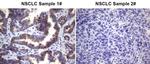 ROS1 Antibody in Immunohistochemistry (Paraffin) (IHC (P))