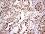 LRRC6 Antibody in Immunohistochemistry (Paraffin) (IHC (P))