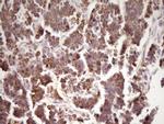 LRRC6 Antibody in Immunohistochemistry (Paraffin) (IHC (P))