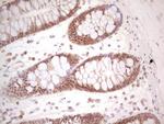 PCBP1 Antibody in Immunohistochemistry (Paraffin) (IHC (P))