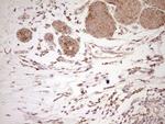 NR0B2 Antibody in Immunohistochemistry (Paraffin) (IHC (P))