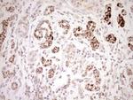 NR0B2 Antibody in Immunohistochemistry (Paraffin) (IHC (P))