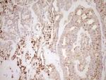 NR0B2 Antibody in Immunohistochemistry (Paraffin) (IHC (P))