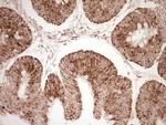 NR0B2 Antibody in Immunohistochemistry (Paraffin) (IHC (P))