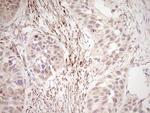 NR0B2 Antibody in Immunohistochemistry (Paraffin) (IHC (P))