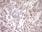 NR0B2 Antibody in Immunohistochemistry (Paraffin) (IHC (P))