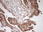 PCBP1 Antibody in Immunohistochemistry (Paraffin) (IHC (P))