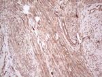 UBE2D2 Antibody in Immunohistochemistry (Paraffin) (IHC (P))