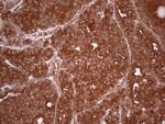 UBE2D2 Antibody in Immunohistochemistry (Paraffin) (IHC (P))