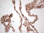 UBE2D2 Antibody in Immunohistochemistry (Paraffin) (IHC (P))